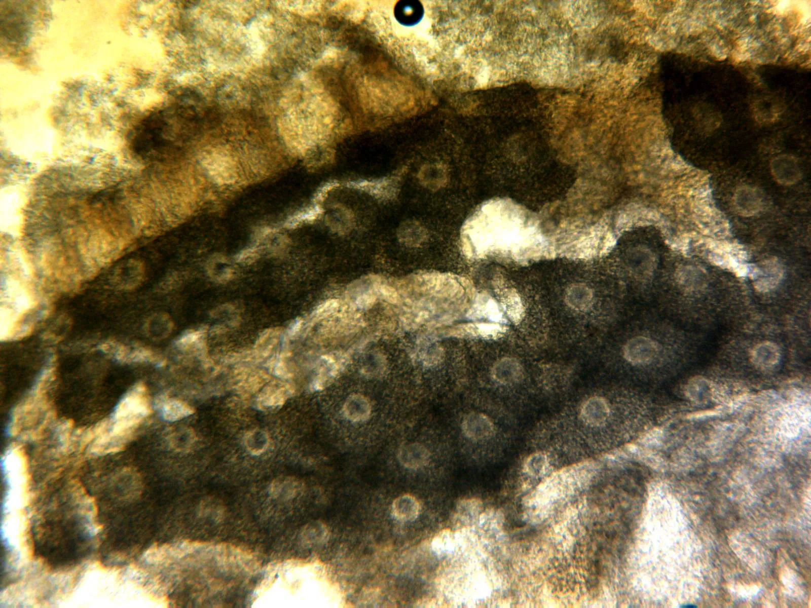 15 - X 100 1